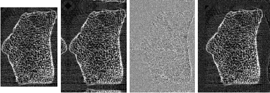 Figure 3 for Three-dimensional Bone Image Synthesis with Generative Adversarial Networks