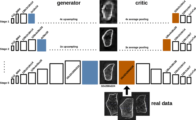 Figure 4 for Three-dimensional Bone Image Synthesis with Generative Adversarial Networks