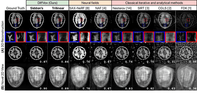 Figure 3 for Differentiable Voxel-based X-ray Rendering Improves Sparse-View 3D CBCT Reconstruction