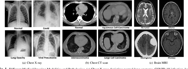 Figure 1 for Can Large Language Models Challenge CNNS in Medical Image Analysis?