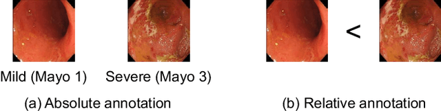 Figure 1 for Deep Bayesian Active Learning-to-Rank with Relative Annotation for Estimation of Ulcerative Colitis Severity