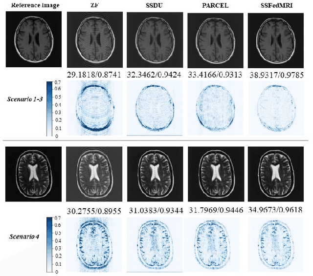 Figure 2 for Self-Supervised Federated Learning for Fast MR Imaging