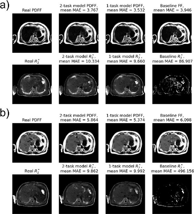 Figure 4 for Synthesizing Proton-Density Fat Fraction and $R_2^*$ from 2-point Dixon MRI with Generative Machine Learning