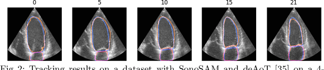 Figure 3 for SonoSAMTrack -- Segment and Track Anything on Ultrasound Images