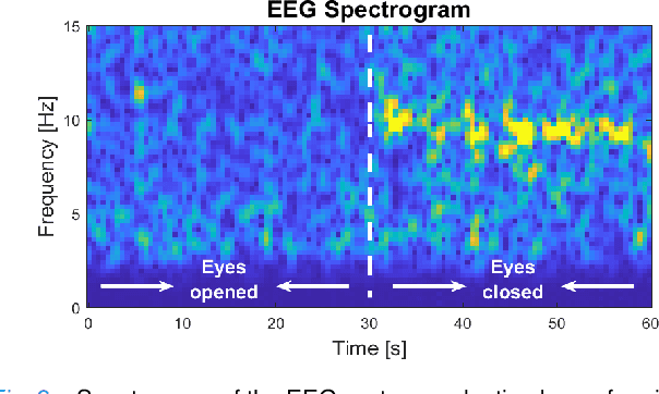 Figure 3 for GAPses: Versatile smart glasses for comfortable and fully-dry acquisition and parallel ultra-low-power processing of EEG and EOG