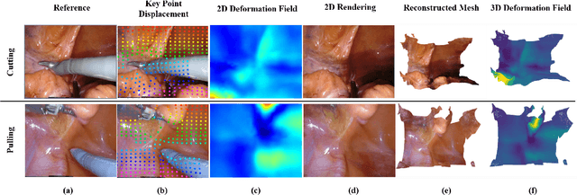 Figure 3 for Tracking-Aware Deformation Field Estimation for Non-rigid 3D Reconstruction in Robotic Surgeries