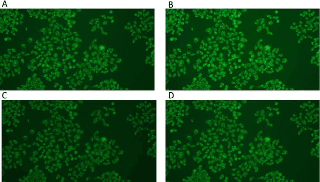 Figure 1 for Evaluating Multiple Instance Learning Strategies for Automated Sebocyte Droplet Counting