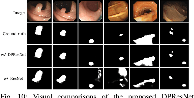 Figure 2 for Salient Object Detection via Dynamic Scale Routing