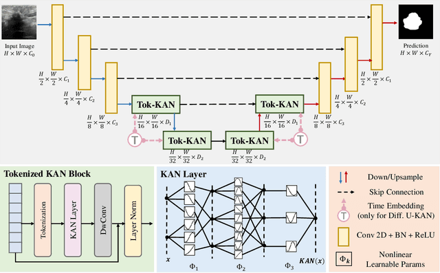 Figure 1 for U-KAN Makes Strong Backbone for Medical Image Segmentation and Generation