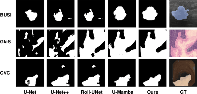 Figure 4 for U-KAN Makes Strong Backbone for Medical Image Segmentation and Generation