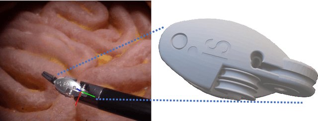 Figure 4 for SurgRIPE challenge: Benchmark of Surgical Robot Instrument Pose Estimation