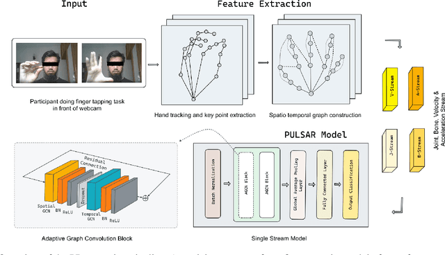 Figure 1 for PULSAR: Graph based Positive Unlabeled Learning with Multi Stream Adaptive Convolutions for Parkinson's Disease Recognition