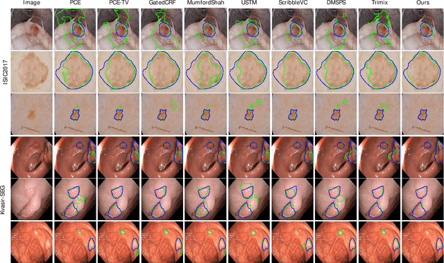 Figure 3 for EAUWSeg: Eliminating annotation uncertainty in weakly-supervised medical image segmentation