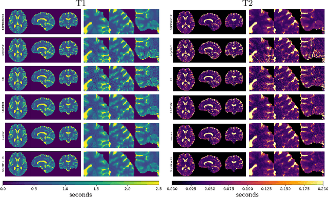 Figure 3 for StoDIP: Efficient 3D MRF image reconstruction with deep image priors and stochastic iterations