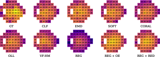 Figure 4 for Generalized Robust Fundus Photography-based Vision Loss Estimation for High Myopia