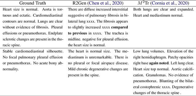 Figure 1 for Boosting Radiology Report Generation by Infusing Comparison Prior