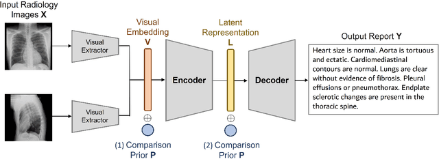 Figure 4 for Boosting Radiology Report Generation by Infusing Comparison Prior