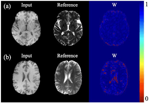 Figure 3 for Reliable Multi-modal Medical Image-to-image Translation Independent of Pixel-wise Aligned Data