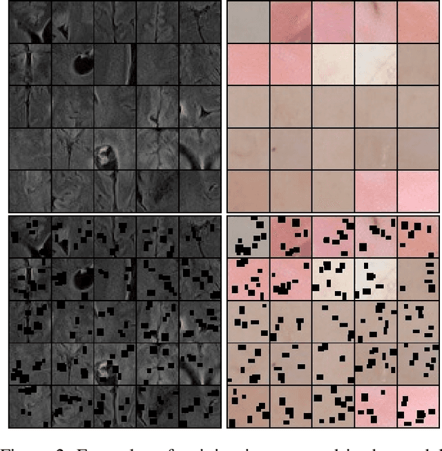 Figure 3 for Unsupervised Patch-GAN with Targeted Patch Ranking for Fine-Grained Novelty Detection in Medical Imaging