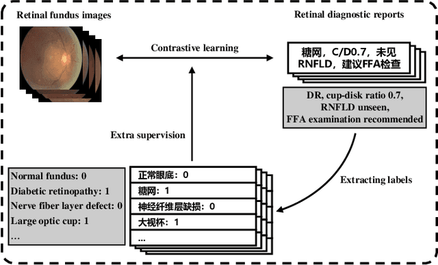 Figure 1 for ViLReF: A Chinese Vision-Language Retinal Foundation Model