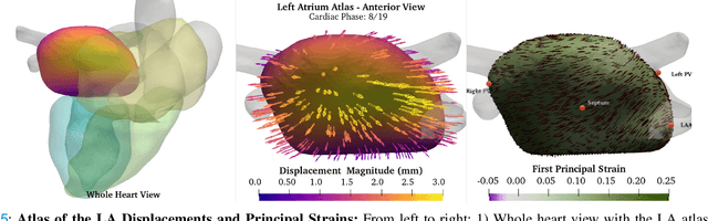 Figure 4 for High-Resolution Maps of Left Atrial Displacements and Strains Estimated with 3D CINE MRI and Unsupervised Neural Networks