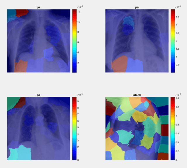 Figure 4 for The Limits of Perception: Analyzing Inconsistencies in Saliency Maps in XAI