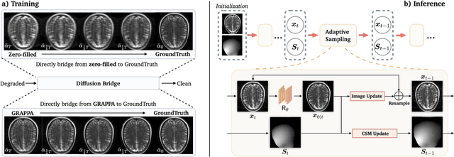 Figure 1 for ADOBI: Adaptive Diffusion Bridge For Blind Inverse Problems with Application to MRI Reconstruction