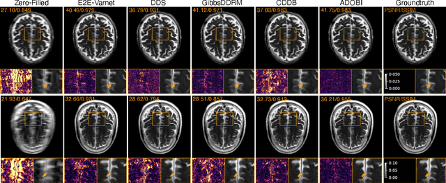 Figure 3 for ADOBI: Adaptive Diffusion Bridge For Blind Inverse Problems with Application to MRI Reconstruction