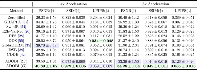 Figure 4 for ADOBI: Adaptive Diffusion Bridge For Blind Inverse Problems with Application to MRI Reconstruction