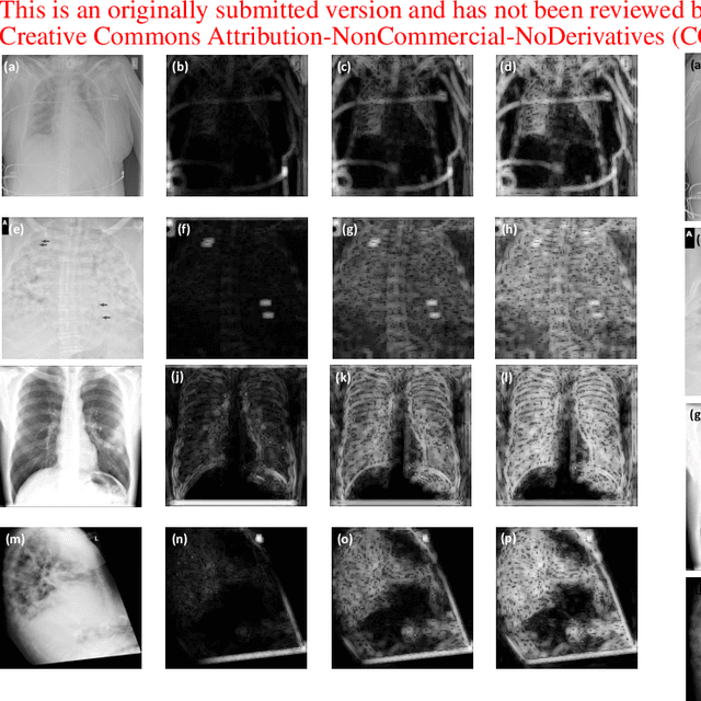 Figure 2 for On The Application Of Log Compression and Enhanced Denoising In Contrast Enhancement Of Digital Radiography Images