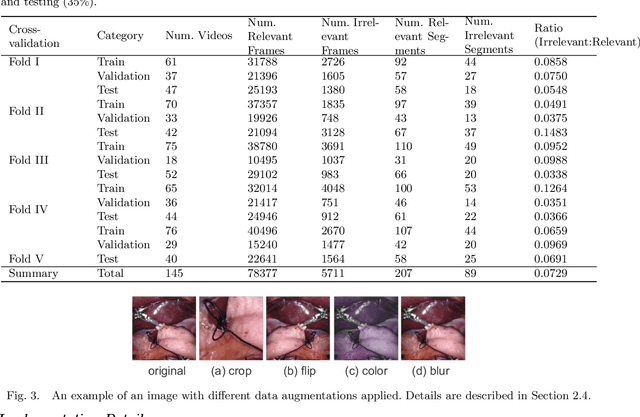 Figure 4 for Automatic Detection of Out-of-body Frames in Surgical Videos for Privacy Protection Using Self-supervised Learning and Minimal Labels