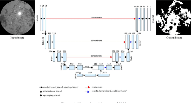 Figure 1 for Treatment classification of posterior capsular opacification (PCO) using automated ground truths