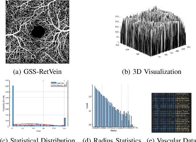 Figure 2 for X-GAN: A Generative AI-Powered Unsupervised Model for High-Precision Segmentation of Retinal Main Vessels toward Early Detection of Glaucoma