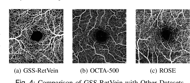 Figure 4 for X-GAN: A Generative AI-Powered Unsupervised Model for High-Precision Segmentation of Retinal Main Vessels toward Early Detection of Glaucoma