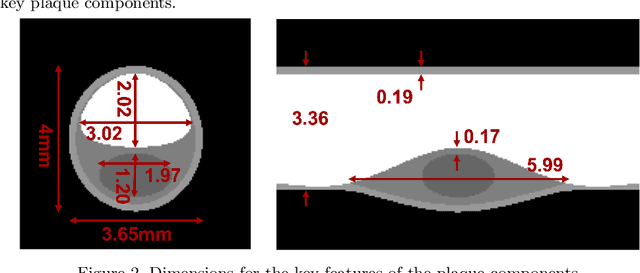 Figure 3 for Coronary Atherosclerotic Plaque Characterization with Photon-counting CT: a Simulation-based Feasibility Study