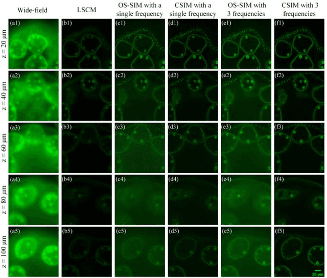 Figure 4 for Confocal structured illumination microscopy