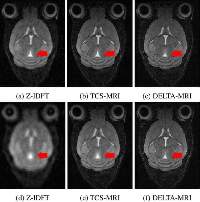 Figure 3 for DELTA-MRI: Direct deformation Estimation from LongiTudinally Acquired k-space data