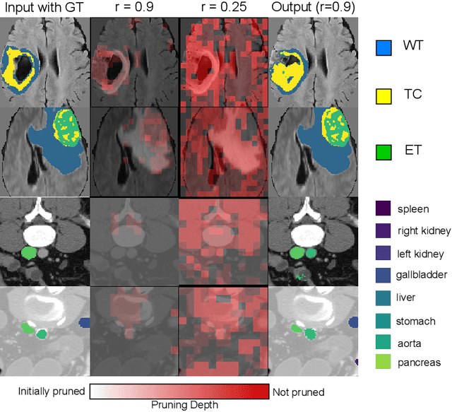 Figure 4 for Token Sparsification for Faster Medical Image Segmentation