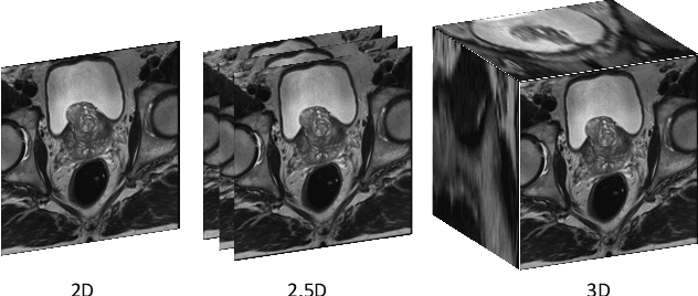 Figure 1 for A Flexible 2.5D Medical Image Segmentation Approach with In-Slice and Cross-Slice Attention