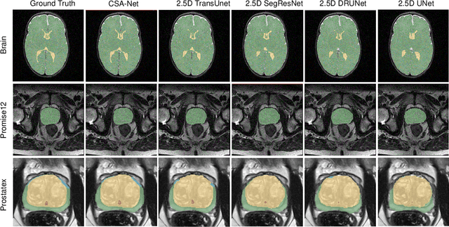 Figure 4 for A Flexible 2.5D Medical Image Segmentation Approach with In-Slice and Cross-Slice Attention