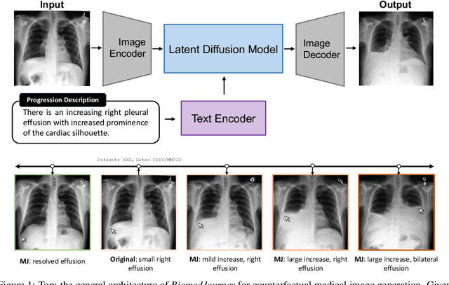 Figure 1 for BiomedJourney: Counterfactual Biomedical Image Generation by Instruction-Learning from Multimodal Patient Journeys