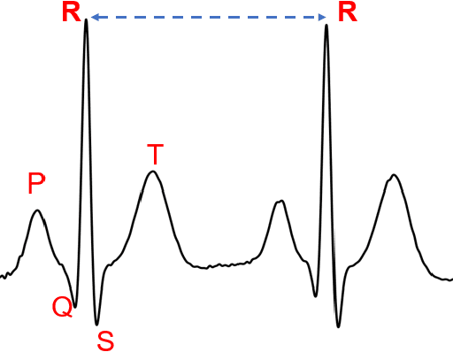 Figure 2 for Stressor Type Matters! -- Exploring Factors Influencing Cross-Dataset Generalizability of Physiological Stress Detection