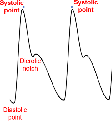 Figure 3 for Stressor Type Matters! -- Exploring Factors Influencing Cross-Dataset Generalizability of Physiological Stress Detection