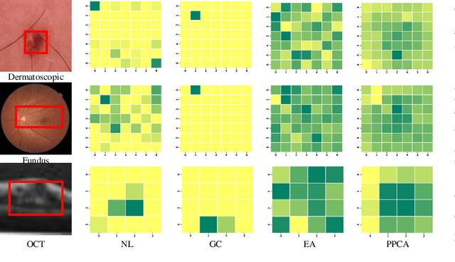 Figure 2 for PPCR: Learning Pyramid Pixel Context Recalibration Module for Medical Image Classification