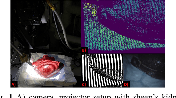 Figure 1 for Collaborative Robotic Ultrasound Tissue Scanning for Surgical Resection Guidance in Neurosurgery