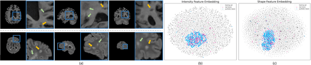 Figure 1 for Self-supervised Brain Lesion Generation for Effective Data Augmentation of Medical Images