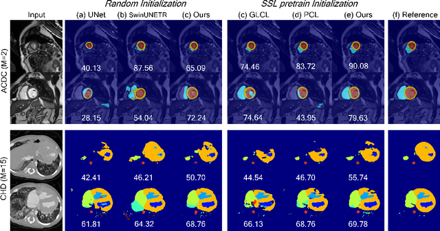 Figure 3 for Keypoint-Augmented Self-Supervised Learning for Medical Image Segmentation with Limited Annotation