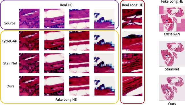 Figure 3 for H&E Stain Normalization using U-Net