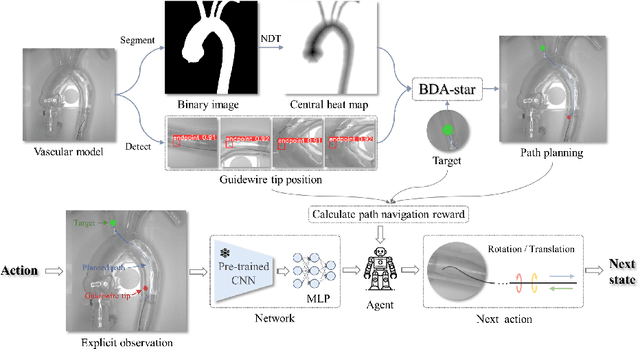 Figure 1 for Image-Guided Autonomous Guidewire Navigation in Robot-Assisted Endovascular Interventions using Reinforcement Learning