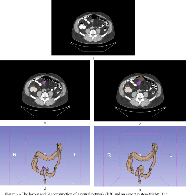Figure 3 for Expanding the Medical Decathlon dataset: segmentation of colon and colorectal cancer from computed tomography images